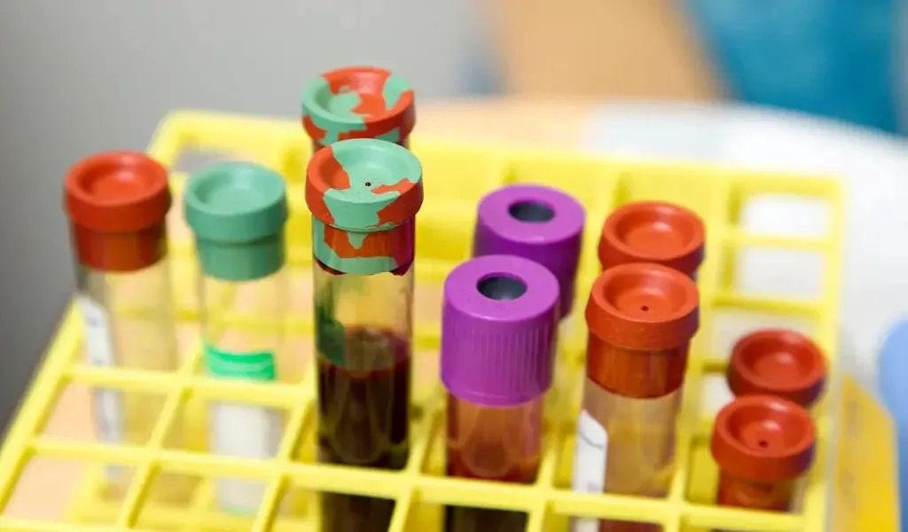 New Breast Cancer Blood Test Is Coming From The University Of Sydney And BCAL