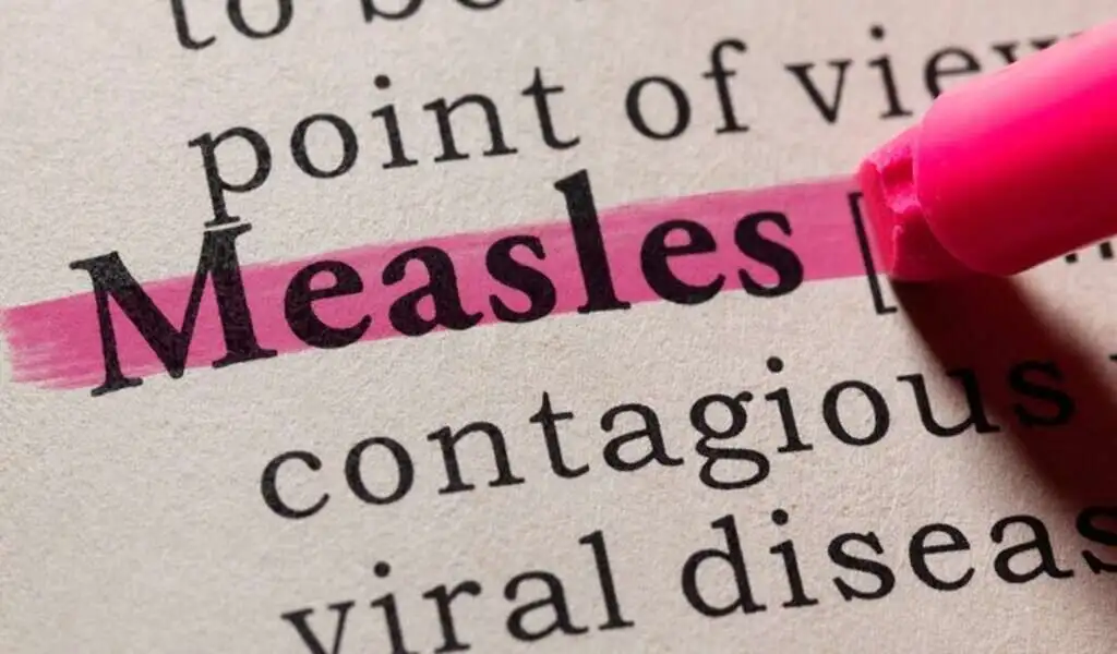 Measles Outbreak Is Possible In St. Louis, According To Health Officials