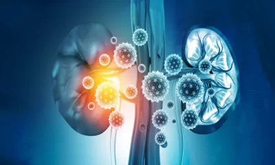 5 Common Causes Of Kidney Damage And How To Shield Your Kidneys