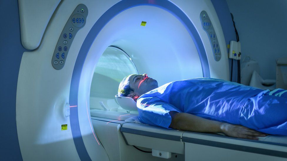 MRI Scans Disclose Pristine Clues into Lengthy Covid Odd Signs