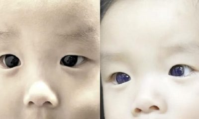 Mother in Thailand Says Her Babies Eyes Turn Blue After COVID-19 Treatment