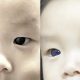 Mother in Thailand Says Her Babies Eyes Turn Blue After COVID-19 Treatment