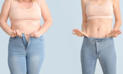 Navigating Gastric Sleeve Surgery in Turkey