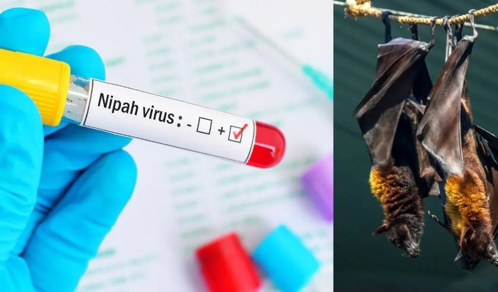 Nipah Virus Outbreak in India What You Need to Know