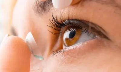 Contact Lenses Cause An Ulcer On a 25-Year-Old Woman's Cornea