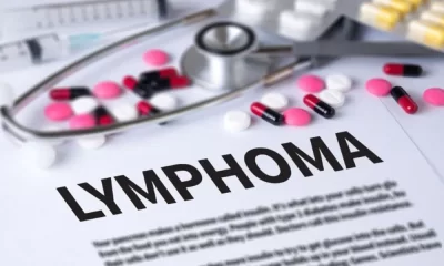 In The Case Of Lymphoma, NICE Recommends Roche Biologics