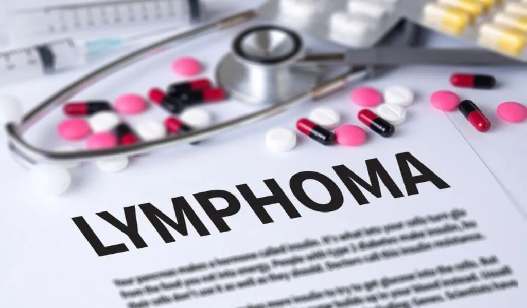 In The Case Of Lymphoma, NICE Recommends Roche Biologics