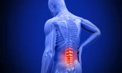 Innovative Treatments for Lumbar Spinal Stenosis: Discovering the Best Options