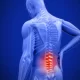 Innovative Treatments for Lumbar Spinal Stenosis: Discovering the Best Options