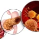 Early Signs and Management of Pancreatic Cancer Explained