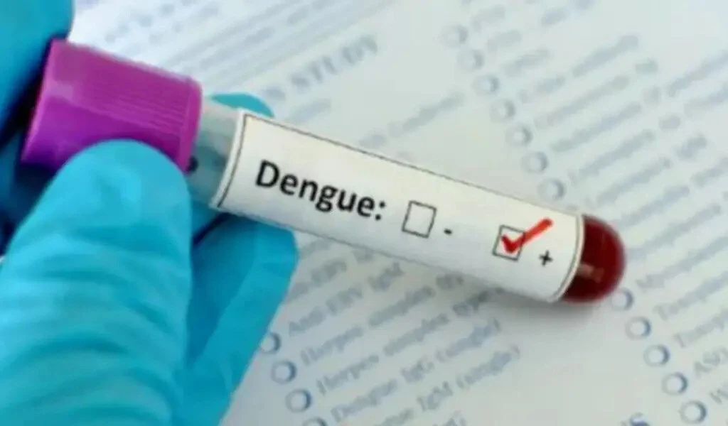Zero Dengue Deaths In Bangladesh, 33 Cases In 24 Hours