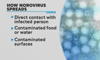 Norovirus Spreading Across US, Northeast Region Hardest Hit