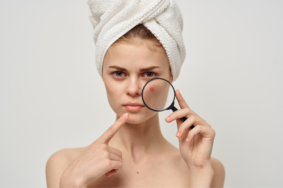 DSK Clinic's Exclusive Custom Scar Planning, Tailored Care Solutions for those battling acne!