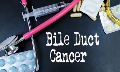 Thailand has highest rate of bile Duct Cancer