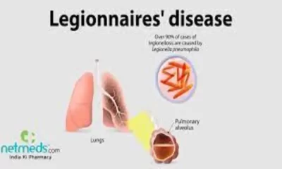 Grand Rapids Legionnaires' Disease Outbreak Source Identified
