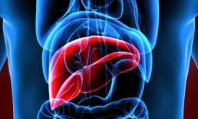 FDA Approves First Drug To Treat a Common, Serious Liver Condition