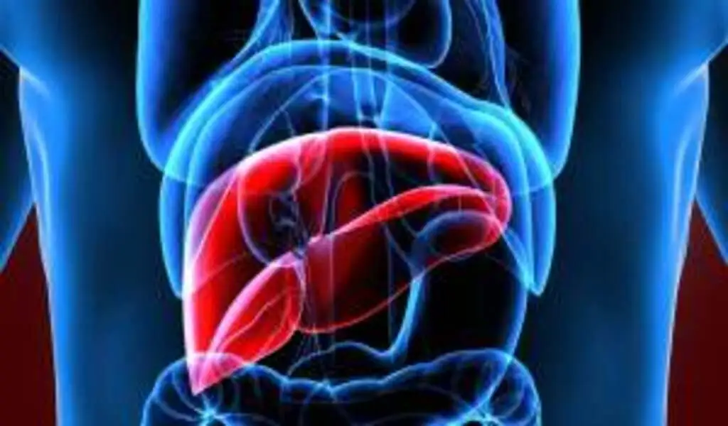 FDA Approves First Drug To Treat a Common, Serious Liver Condition