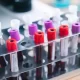 Colorectal Cancer Blood Test Shows Promise In Early Detection, Study Finds