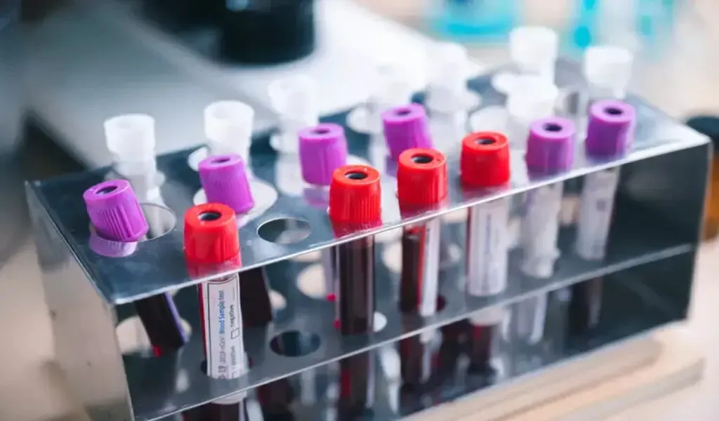 Colorectal Cancer Blood Test Shows Promise In Early Detection, Study Finds