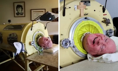 Paul Alexander, a polio Survivor who lived inside an Iron Lung for 72 Years, has Died