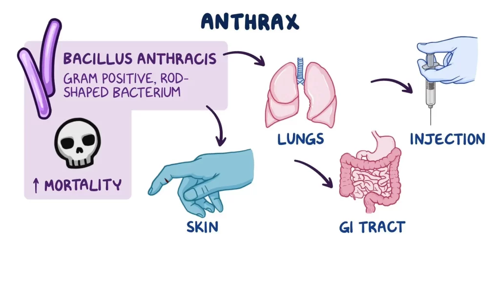 anthrax