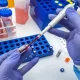 Study: Colorectal Cancer Blood Test Could Be Approved In 2024