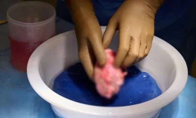 Pig Kidney Transplant Successful For First Living Human