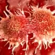 Screening For Breast Cancer Is Effective Based On Detection Methods