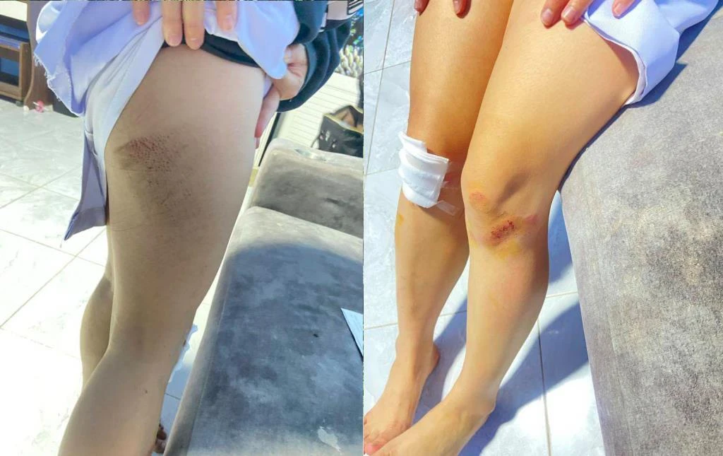 Nurse Attacked Chiang Rai