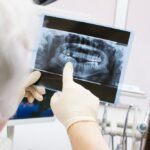 Dentist, Ozempic, toothe decay