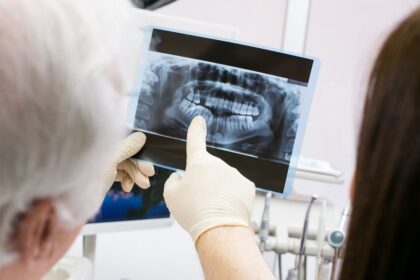 Dentist, Ozempic, toothe decay