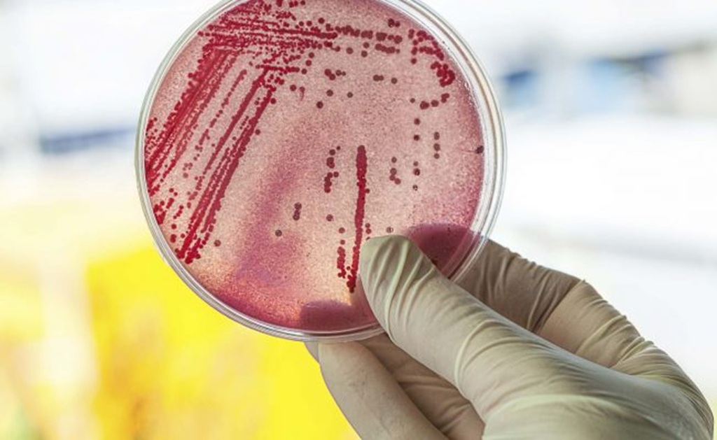 Flesh-eating bacterial infection