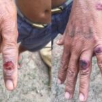 Thailand's DDC Reports New Case of Anthrax in Eastern Thailand