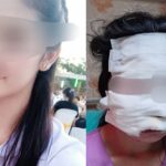 SAMUT SAKHON - A 32-year-old woman has made a police report after being subjected to severe violence and nearly killed by her husband.