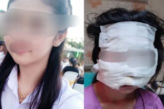 SAMUT SAKHON - A 32-year-old woman has made a police report after being subjected to severe violence and nearly killed by her husband.