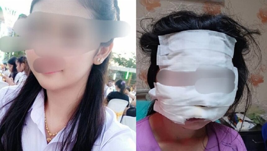 SAMUT SAKHON - A 32-year-old woman has made a police report after being subjected to severe violence and nearly killed by her husband.