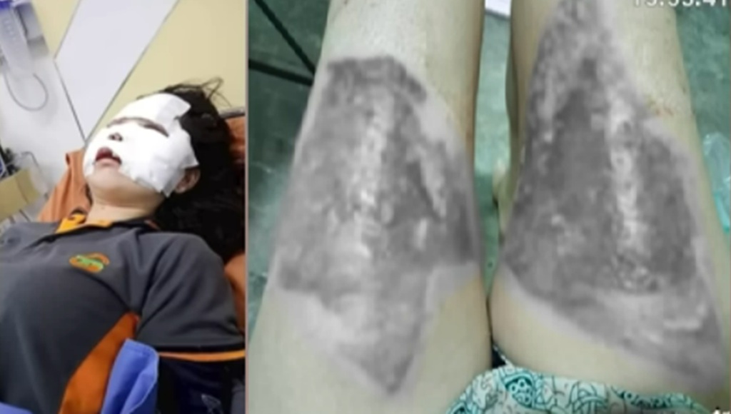 Husband Tortured Wife