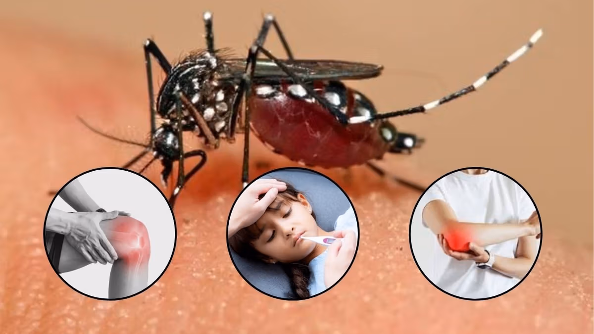 Chikungunya Virus