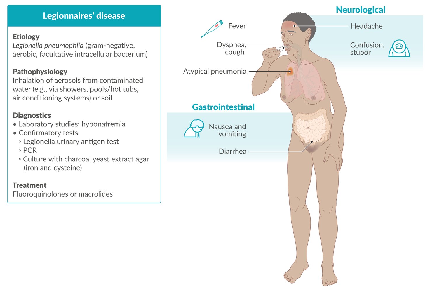 Legionnaires’ Disease