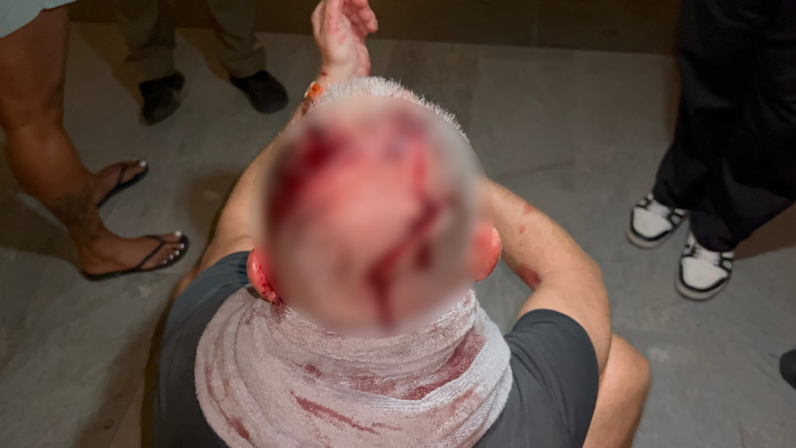 The victim, named Mr Kirkwood, suffered serious head wounds