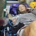 Police Hunt for Youth Gang After 14-Years Old Girl Slashed With Machete