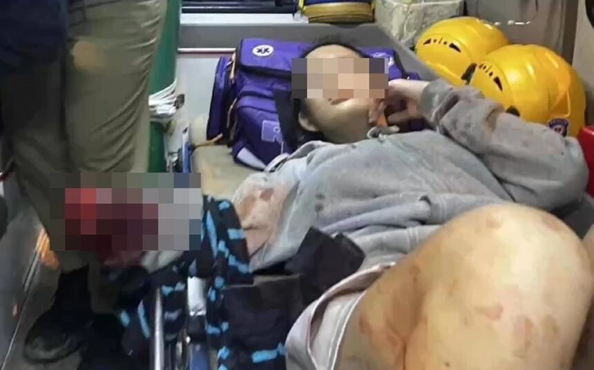 Police Hunt for Youth Gang After 14-Years Old Girl Slashed With Machete