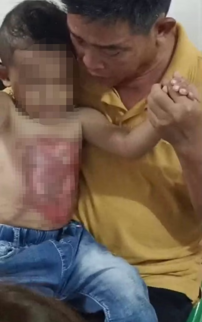 Boy scalded at clinic