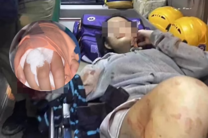 Chiang Mai Sword Attack, girls hand severed