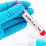 Nipah Virus in Thailand? What’s Confirmed, What’s Not, and How to Stay Safe