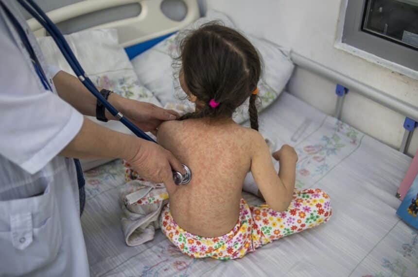 measles, Thailand