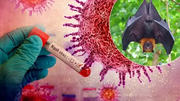 Targeted Nipah Virus Screening