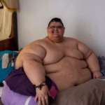 World’s Heaviest Man Juan Pedro Franco Dies at 41: What His Story Says About Severe Obesity