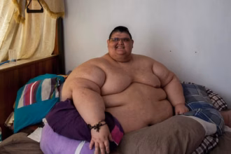 World’s Heaviest Man Juan Pedro Franco Dies at 41: What His Story Says About Severe Obesity