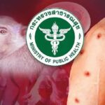 Monkey Pox (Mpox) Cases in Thailand